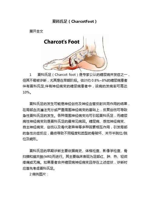 夏科氏足（Charcotfoot）