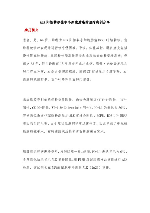 ALK阳性转移性非小细胞肺癌的治疗病例分享