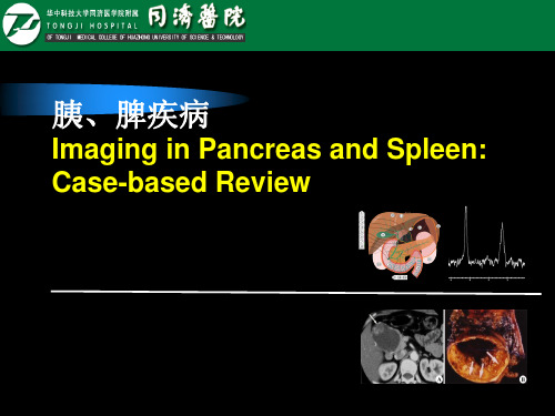 胰腺 脾脏 -精品医学课件