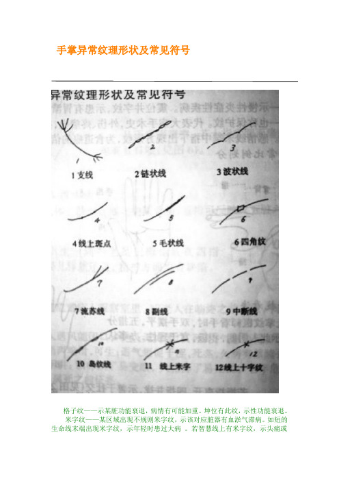 手诊常见符号