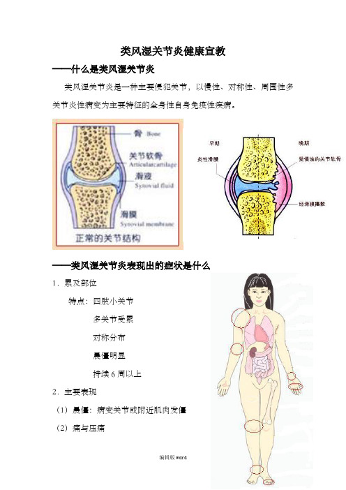 类风湿关节炎健康宣教模板