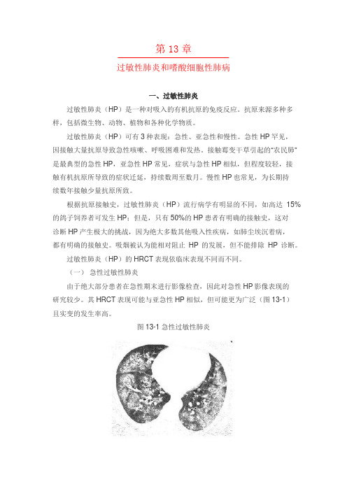 高分辨CT-过敏性肺炎和嗜酸细胞性肺病