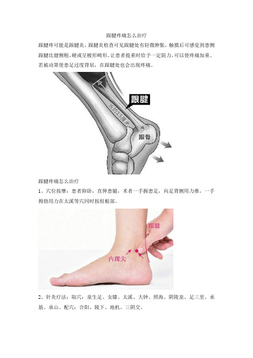 跟腱疼痛怎么治疗