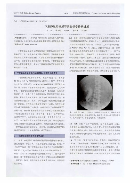 下腔静脉后输尿管的影像学诊断进展