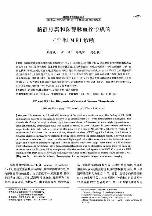 脑静脉窦和深静脉血栓形成的