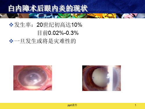 白内障手术前后眼内炎的预防诊断与治疗  ppt课件