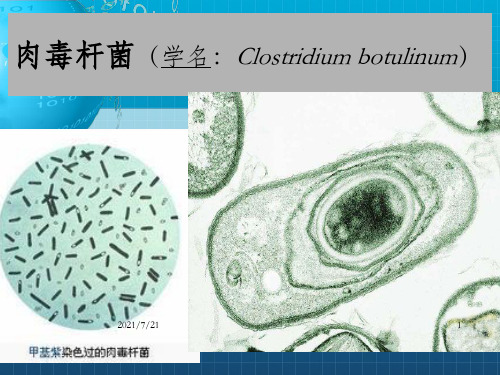 《肉毒杆菌》PPT课件