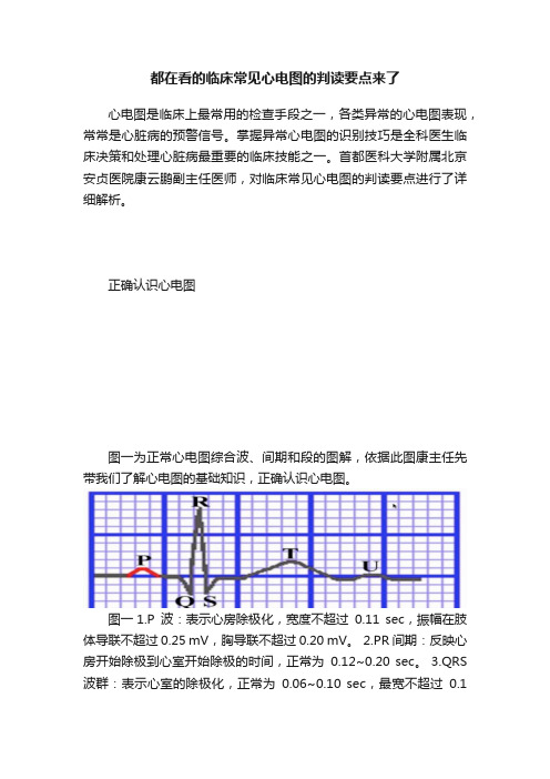 都在看的临床常见心电图的判读要点来了