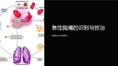 急性胸痛的识别与救治