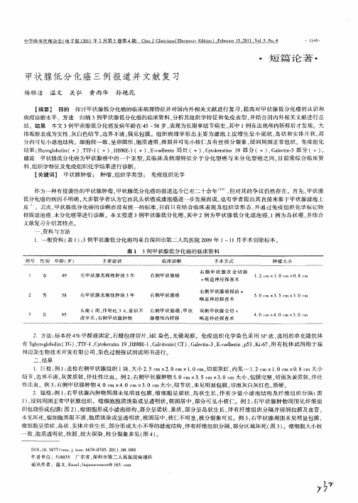 甲状腺低分化癌三例报道并文献复习