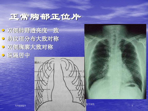 临床执业医师实践技能考试影像学X线CTB超培训课件