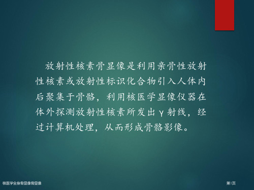 核医学全身骨显像骨显像