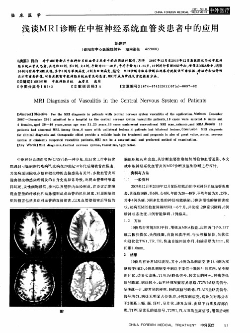 浅谈MRI诊断在中枢神经系统血管炎患者中的应用