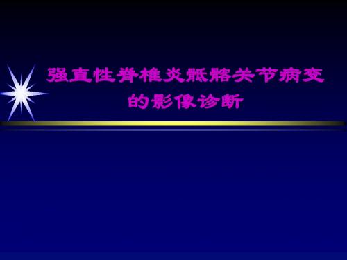 强直性脊椎炎骶髂关节病变的影像诊断