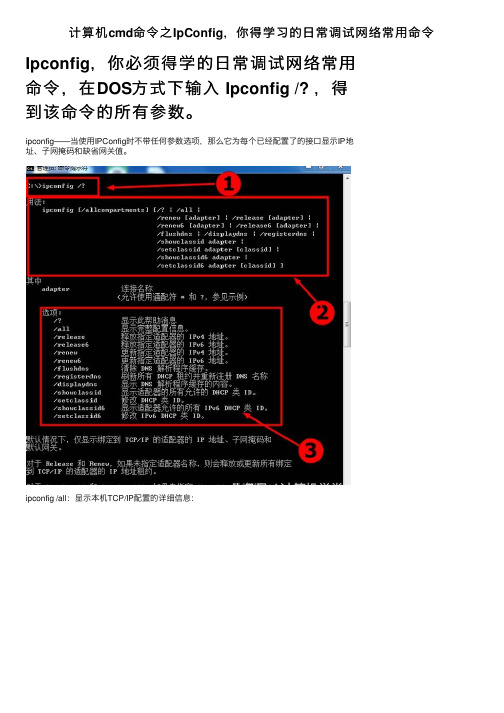 计算机cmd命令之IpConfig，你得学习的日常调试网络常用命令