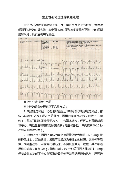 室上性心动过速的紧急处理