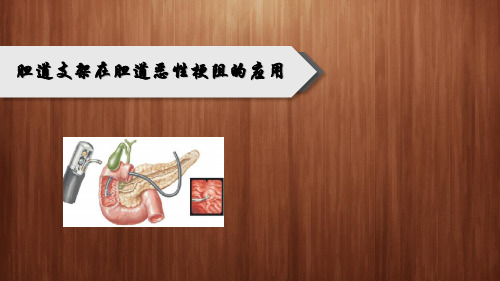 胆道支架在胆道恶性梗阻的应用(1)