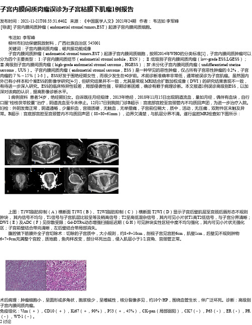 子宫内膜间质肉瘤误诊为子宫粘膜下肌瘤1例报告