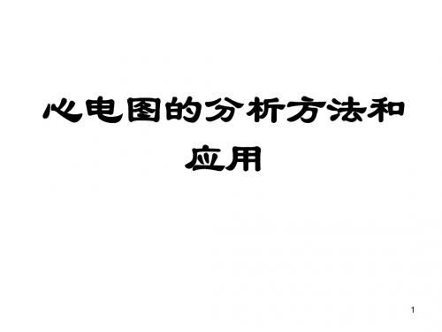 最新 ECG总论 (心电图分析法)(98页)