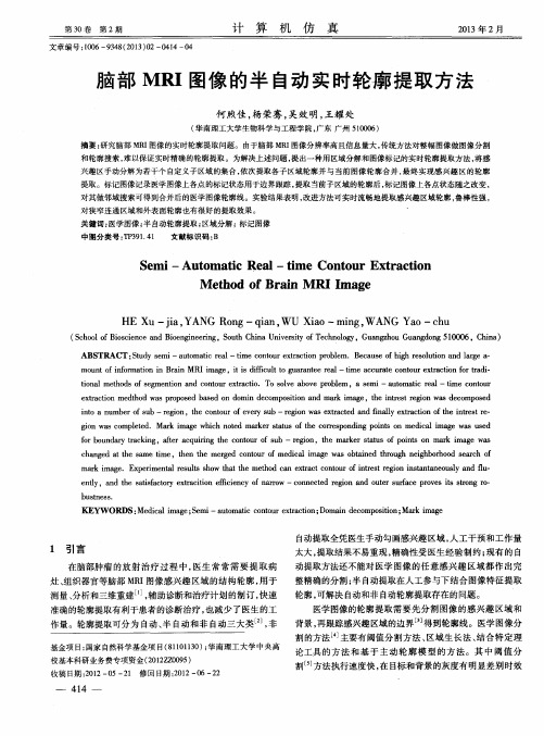 脑部MRI图像的半自动实时轮廓提取方法