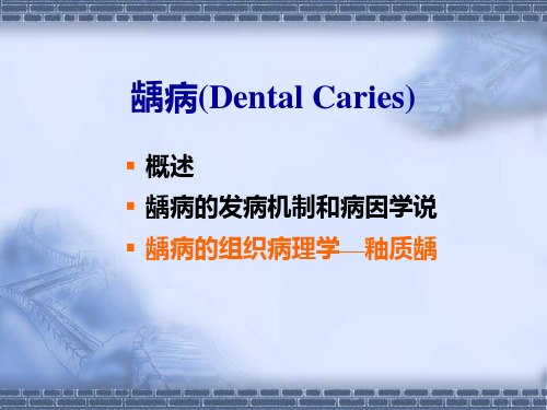 龋病(Dental Caries) PPT