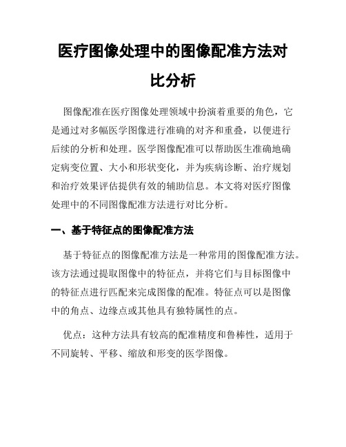 医疗图像处理中的图像配准方法对比分析