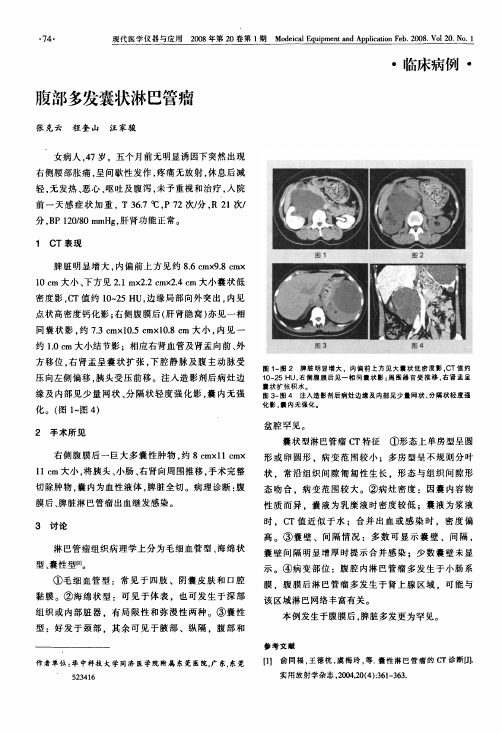 腹部多发囊状淋巴管瘤