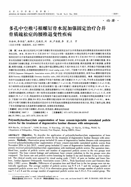 多孔中空椎弓根螺钉骨水泥加强固定治疗合并骨质疏松症的腰椎退变性疾病