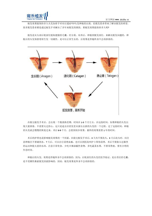 植发效果能保持多久头发加密手术有后遗症吗