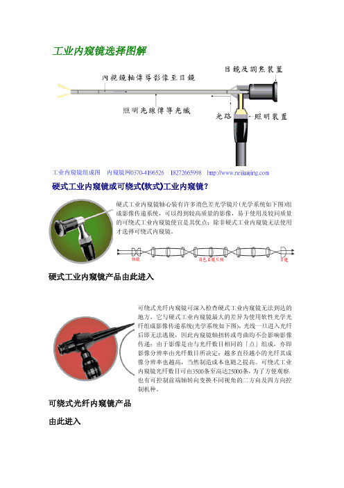 内窥镜选择图解