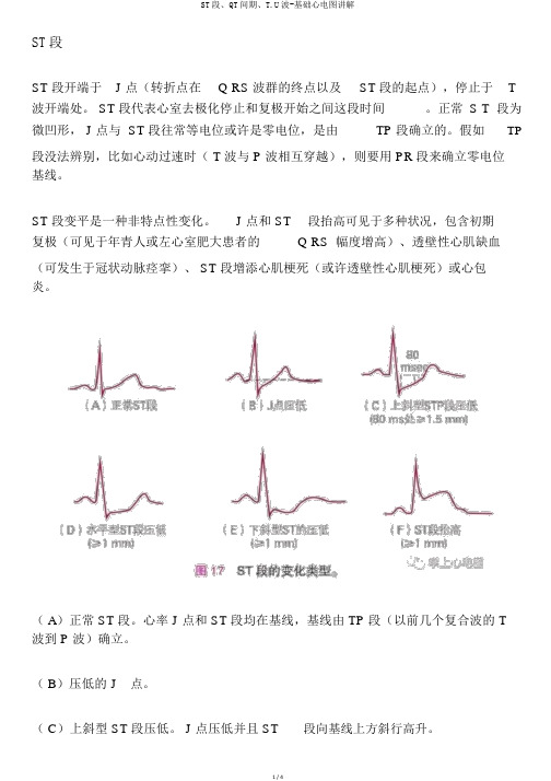 ST段、QT间期、T.U波-基础心电图讲解