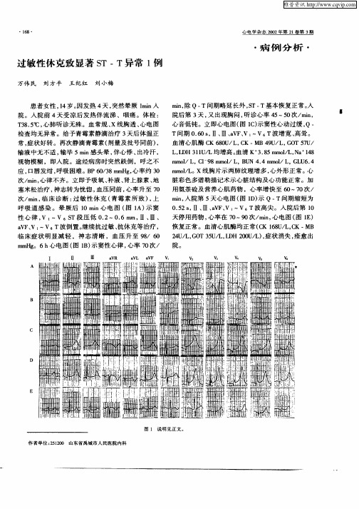 过敏性休克致显著ST—T异常1例