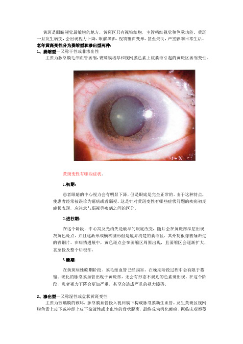 黄斑变性的症状及治疗方案