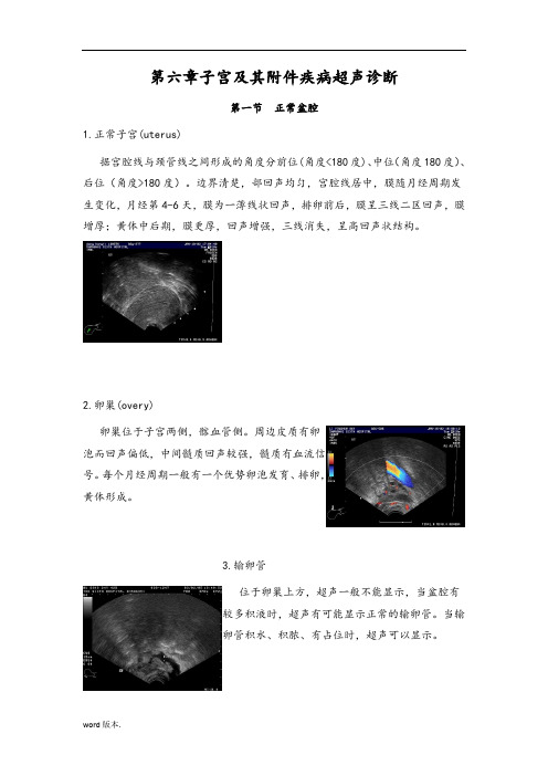 超声诊断学教程-第六章子宫及其附件疾病超声诊断