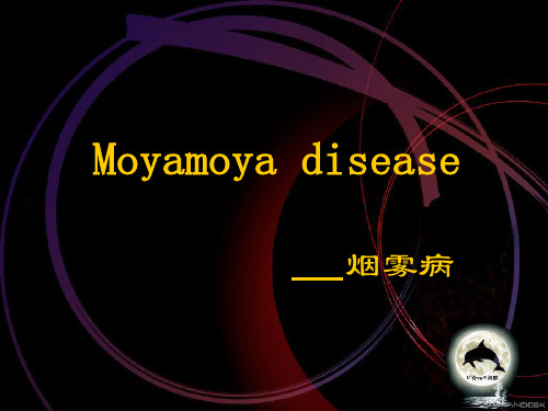 烟雾病(Moyamoya disease)