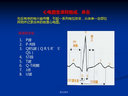 各种心电图表现最新版本