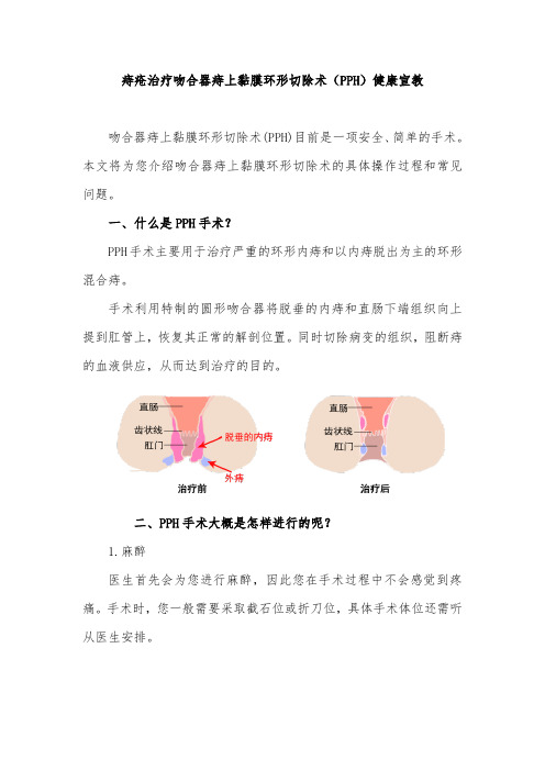 痔疮治疗吻合器痔上黏膜环形切除术(PPH)健康宣教