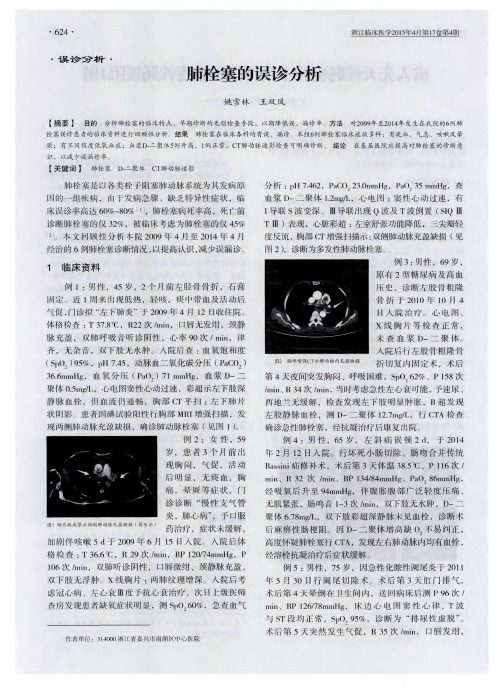 肺栓塞的误诊分析