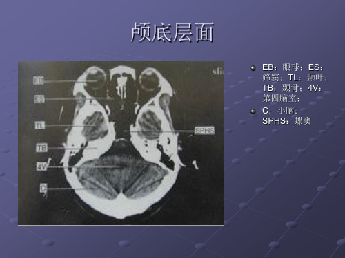 神经内科影像学基础