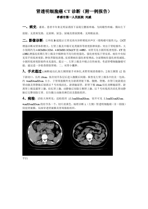 肾透明细胞癌CT诊断