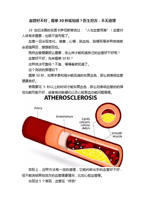 血管好不好，握拳30秒就知道？医生坦言：不无道理