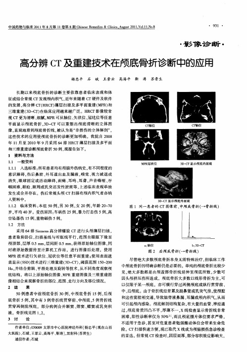 高分辨CT及重建技术在颅底骨折诊断中的应用