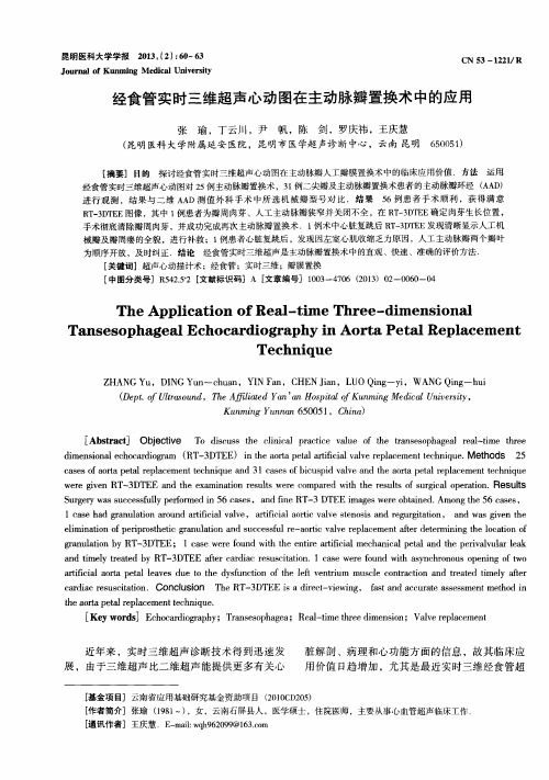 经食管实时三维超声心动图在主动脉瓣置换术中的应用