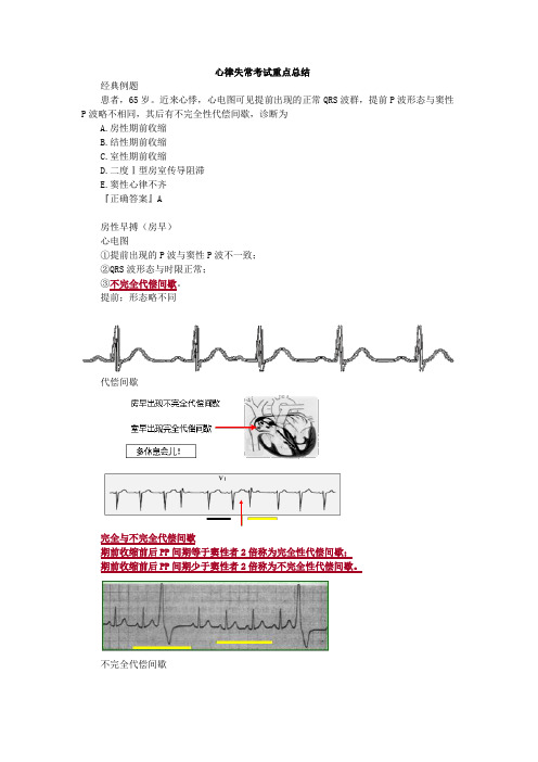 心律失常考试重点总结