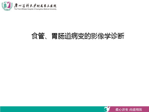 食管、胃肠道病变的影像学诊断-精品医学课件