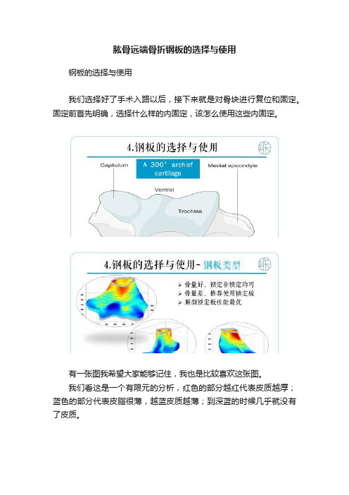 肱骨远端骨折钢板的选择与使用