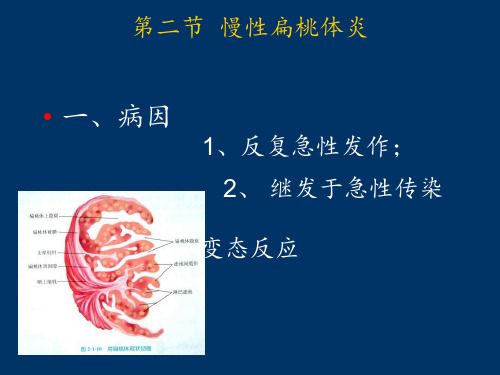 禁忌症1急性扁桃体炎发作时ppt课件