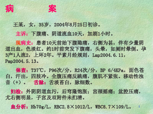 异位妊娠