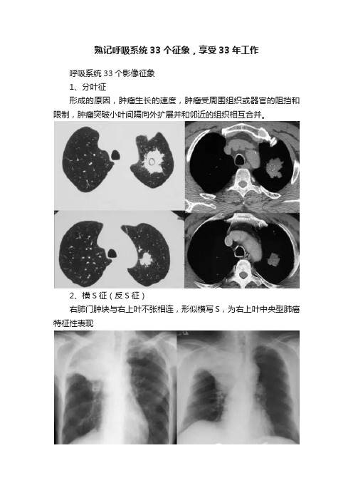 熟记呼吸系统33个征象，享受33年工作