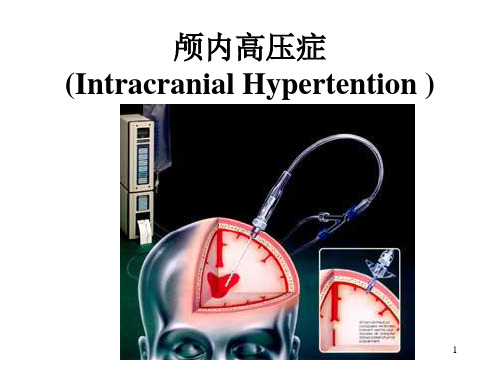 颅内高压症PPT课件